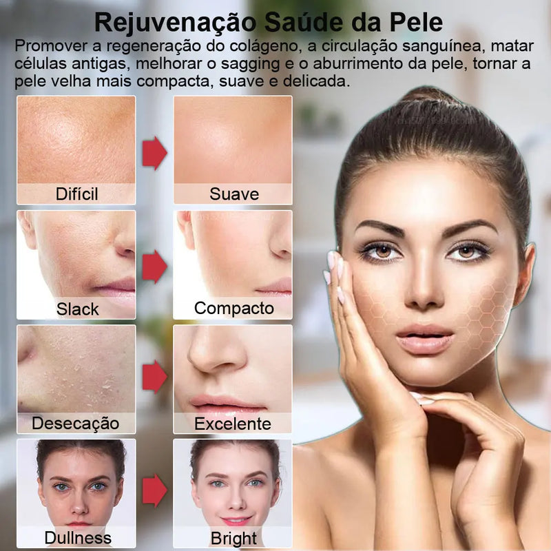 Face Lifting Facial Skin Rejuvenecedor